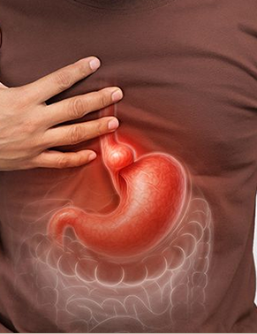 Cirurgia antirrefluxo e correção de hérnia hiatal