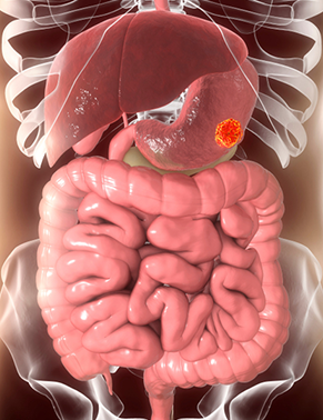 Cirurgias do estômago, intestino delgado, cólon e reto