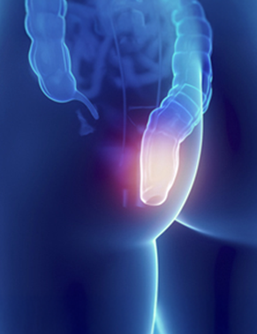 Tratamento cirúrgico de hemorroidas, fissuras e fístulas anais