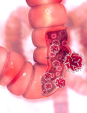 Cirurgia oncológica do trato gastrointestinal